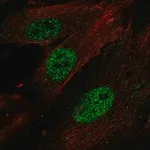 Merck Anti-HOXA11 antibody produced in rabbit