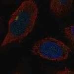 Merck Anti-B4GALT2 antibody produced in rabbit