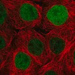 Merck Anti-DUSP18 antibody produced in rabbit