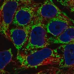 Merck Anti-AKAP1 antibody produced in rabbit