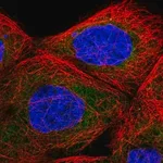 Merck Anti-TBL2 antibody produced in rabbit