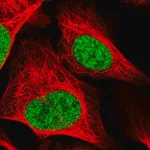 Merck Anti-RAD54L antibody produced in rabbit