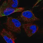 Merck Anti-ADAM17 antibody produced in rabbit