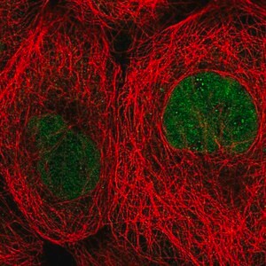 Merck Anti-TBCK antibody produced in rabbit