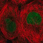 Merck Anti-TBCK antibody produced in rabbit