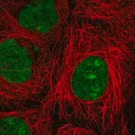 Merck Anti-NSMCE2 antibody produced in rabbit