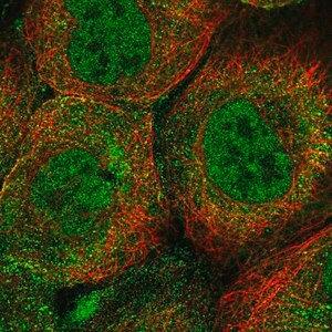 Merck Anti-UBE2A antibody produced in rabbit