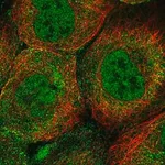 Merck Anti-UBE2A antibody produced in rabbit