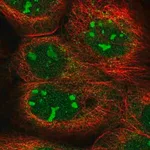 Merck Anti-KRR1 antibody produced in rabbit