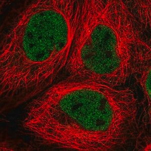 Merck Anti-RNF20 antibody produced in rabbit