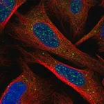 Merck Anti-CHIC1 antibody produced in rabbit