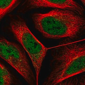 Merck Anti-DSE antibody produced in rabbit