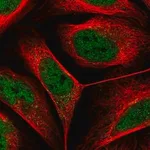 Merck Anti-DSE antibody produced in rabbit