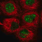 Merck Anti-TYW1 antibody produced in rabbit