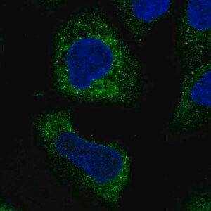Merck Anti-WISP3 antibody produced in rabbit
