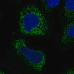 Merck Anti-WISP3 antibody produced in rabbit