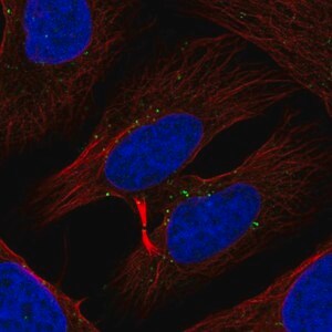 Merck Anti-TXK antibody produced in rabbit