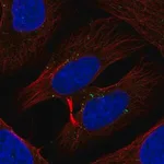 Merck Anti-TXK antibody produced in rabbit