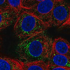 Merck Anti-ACBD7 antibody produced in rabbit