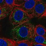 Merck Anti-ACBD7 antibody produced in rabbit