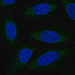 Merck Anti-ALG6 antibody produced in rabbit