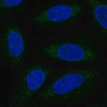 Merck Anti-ALG6 antibody produced in rabbit