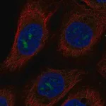 Merck Anti-MPPED2 antibody produced in rabbit