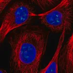 Merck Anti-FTSJ3 antibody produced in rabbit
