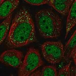 Merck Anti-PNPLA2 antibody produced in rabbit