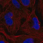 Merck Anti-ZNF616 antibody produced in rabbit