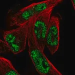 Merck Anti-MSANTD3 antibody produced in rabbit