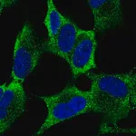 Merck Anti-MEX3A antibody produced in rabbit