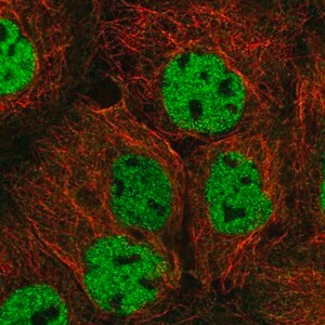 Merck Anti-ORAOV1 antibody produced in rabbit