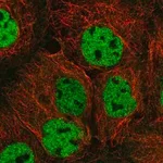 Merck Anti-ORAOV1 antibody produced in rabbit