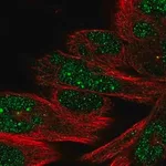 Merck Anti-DHX35 antibody produced in rabbit