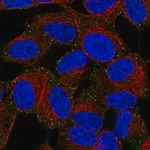 Merck Anti-LIMD2 antibody produced in rabbit