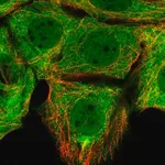 Merck Anti-FKBP4 antibody produced in rabbit