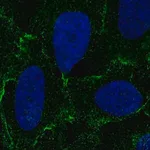 Merck Anti-DSC3 antibody produced in rabbit