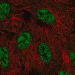 Merck Anti-SMG1 antibody produced in rabbit