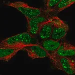 Merck Anti-TDP2 antibody produced in rabbit