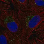 Merck Anti-ZNF625 antibody produced in rabbit
