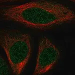 Merck Anti-HOXA7 antibody produced in rabbit