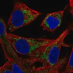 Merck Anti-PMPCB antibody produced in rabbit