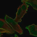 Merck Anti-PALM2 antibody produced in rabbit