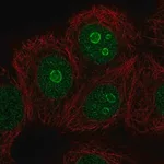 Merck Anti-METTL22 antibody produced in rabbit