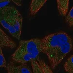 Merck Anti-TSC1 antibody produced in rabbit