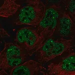 Merck Anti-RNF34 antibody produced in rabbit