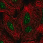 Merck Anti-GLI2 antibody produced in rabbit