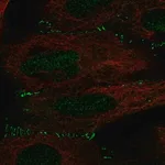 Merck Anti-ALKBH6 antibody produced in rabbit