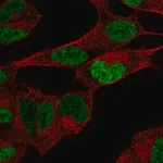Merck Anti-PHOX2B antibody produced in rabbit